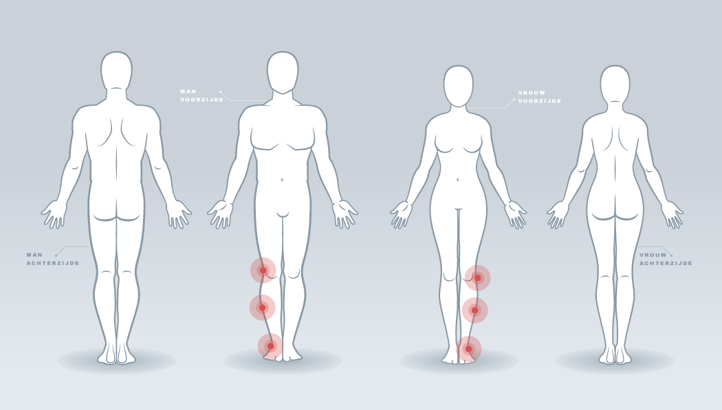 Oefeningen Knie- Enkel- Onderbeen