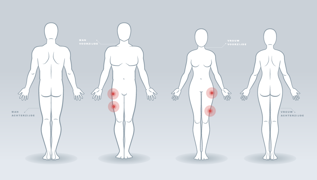 Oefeningen Heup/Bovenbeen